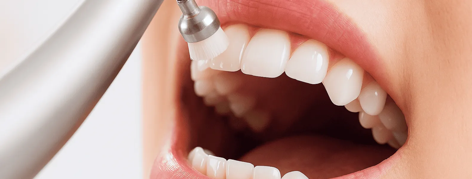 ガミースマイルの診断から治療まで｜低侵襲で美しい口元に