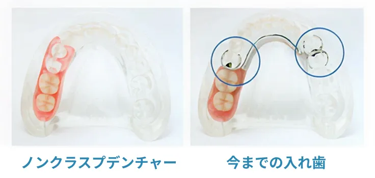 ほとんど目立ちません