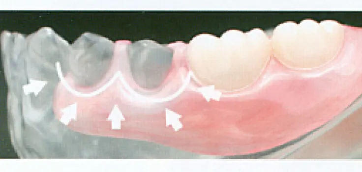 しっかりホールド