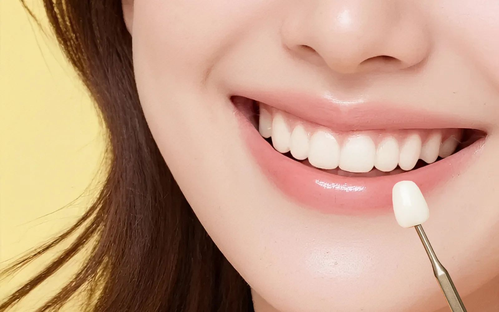 削らないラミネートベニア