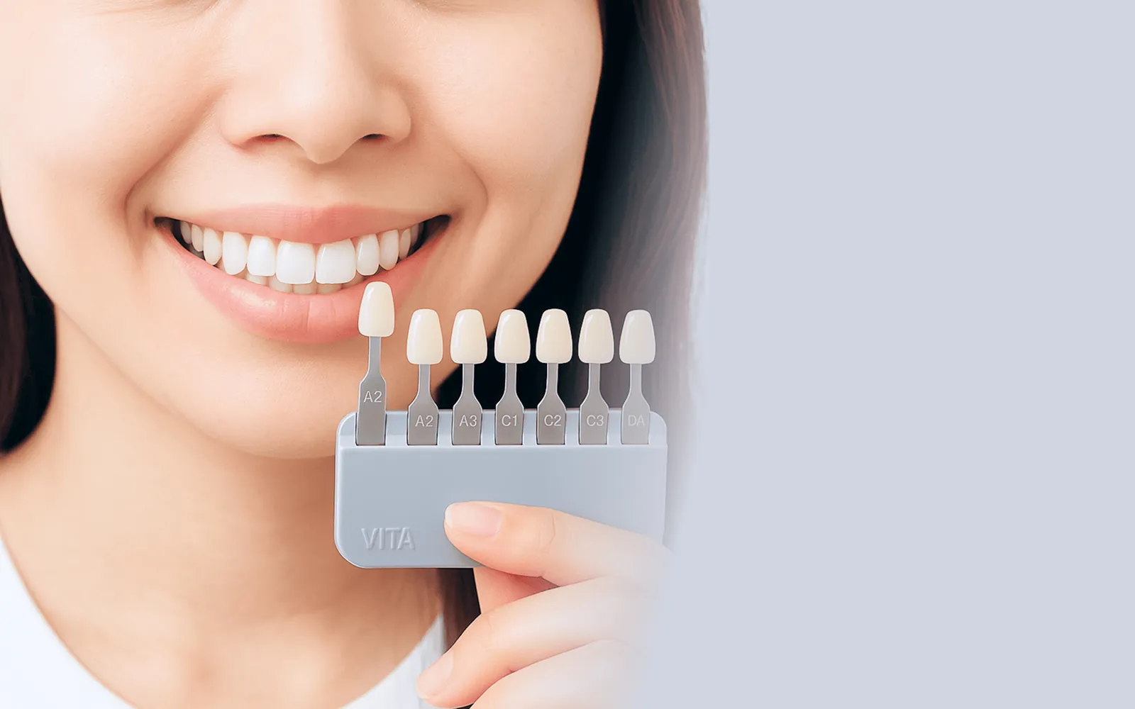 ホワイトニング