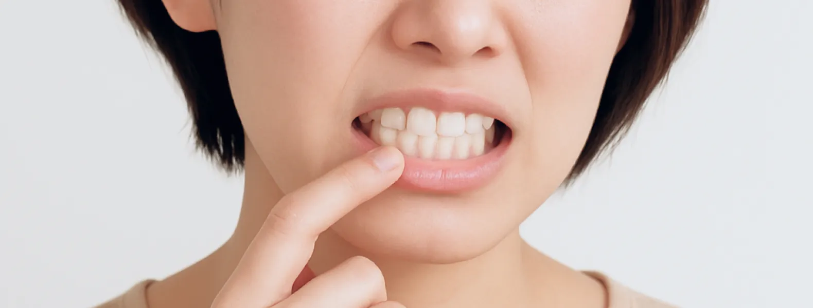 インビザラインGOに適しているケース