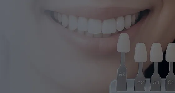 ホワイトニング