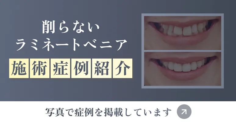 奥歯のセラミック治療症例紹介