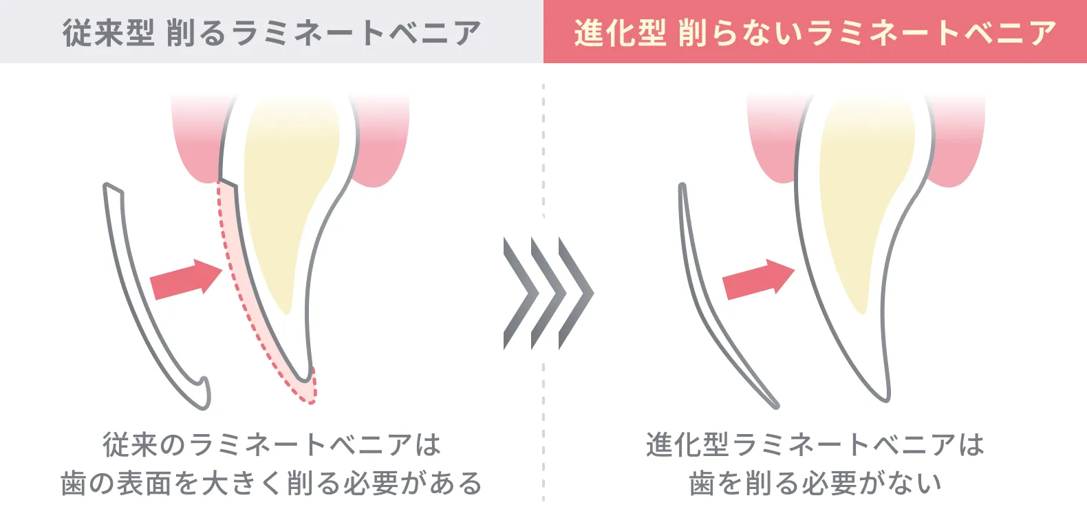 従来型と進化型の比較